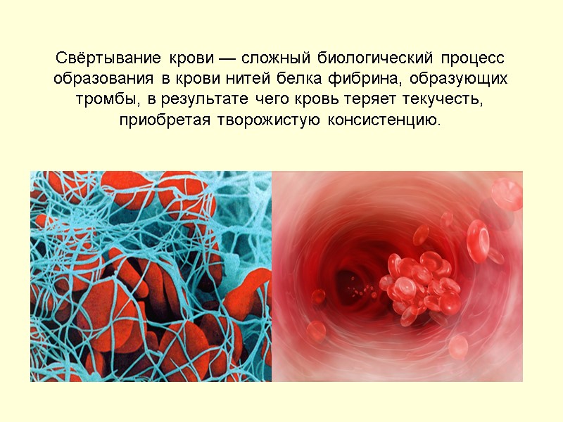 Свёртывание крови — сложный биологический процесс образования в крови нитей белка фибрина, образующих тромбы,